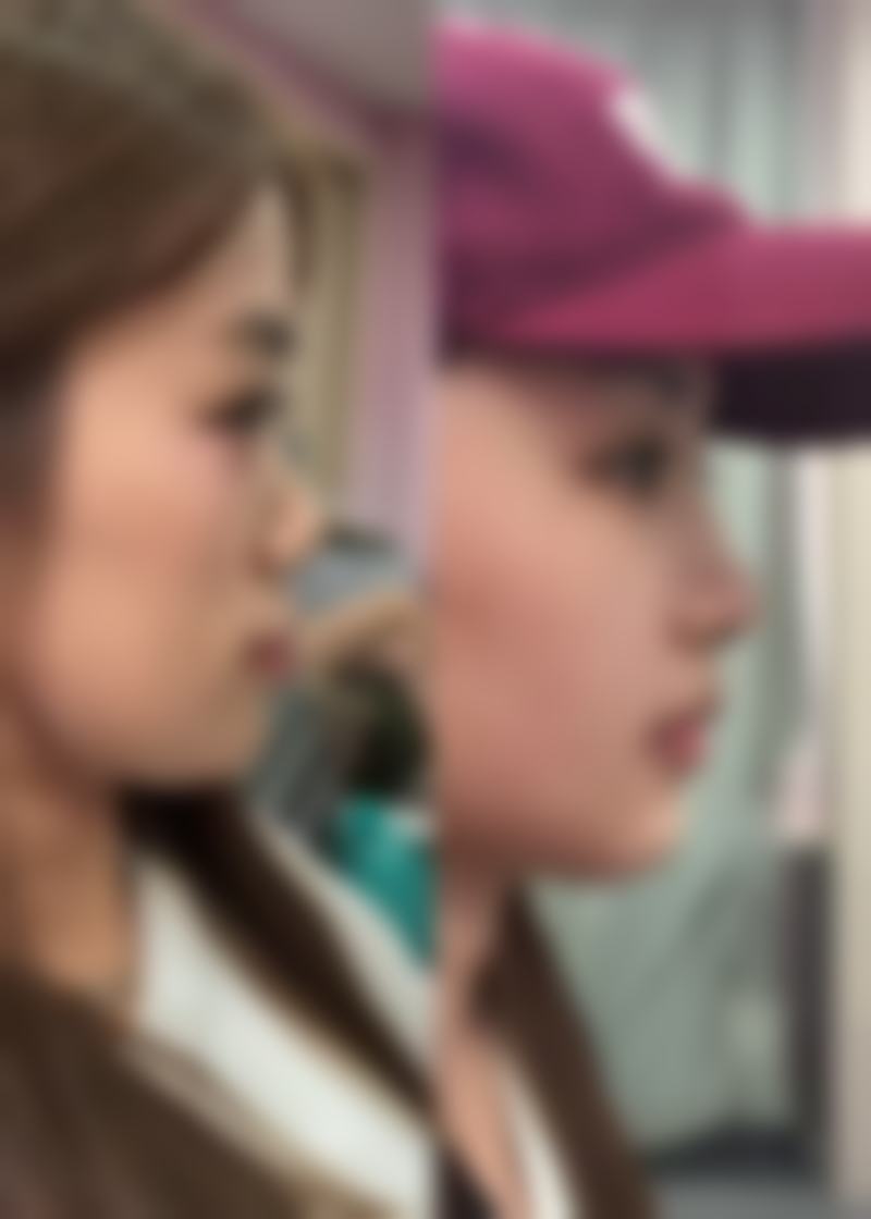 深圳香格里医疗美容门诊部治疗反馈与口碑评价。