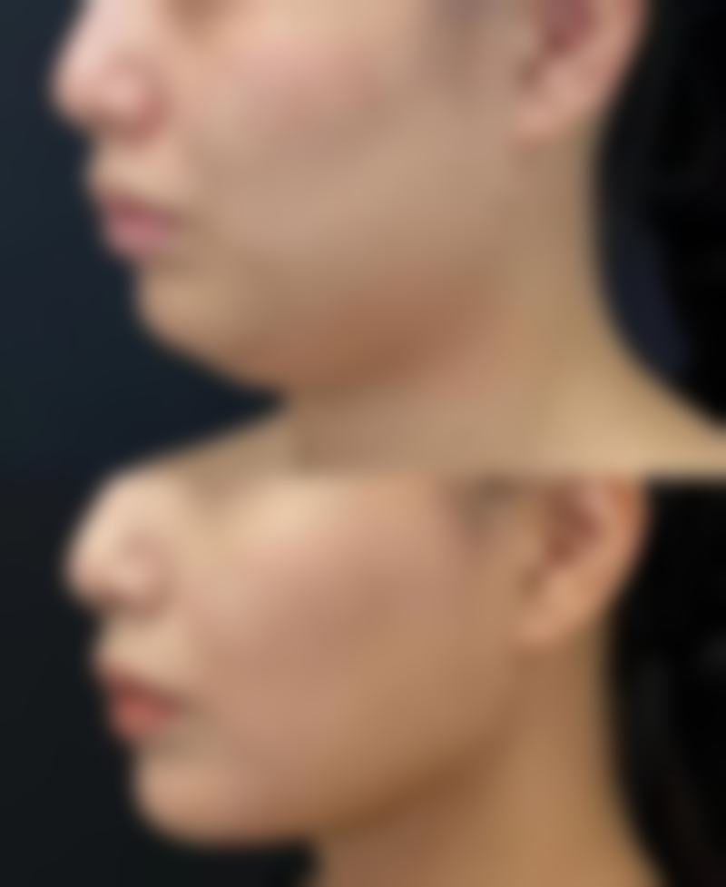 六盘水吴氏嘉美整形医疗美容门诊部预约挂号方式。