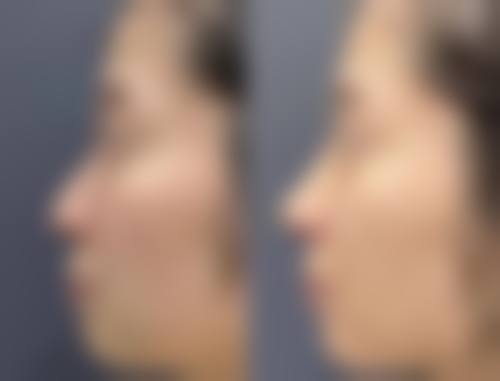 哈尔滨韩彩医疗美容门诊部擅长项目