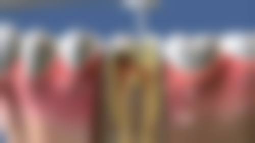 四、江苏苏州苏航口腔诊所特色项目