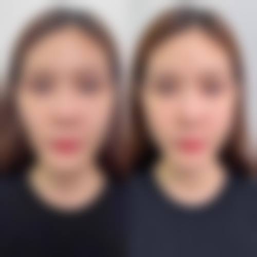 永州瑞澜医疗美容医院口碑评价