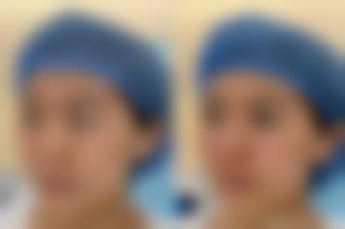 深圳柏悦医疗美容门诊部2026年价格收费表：