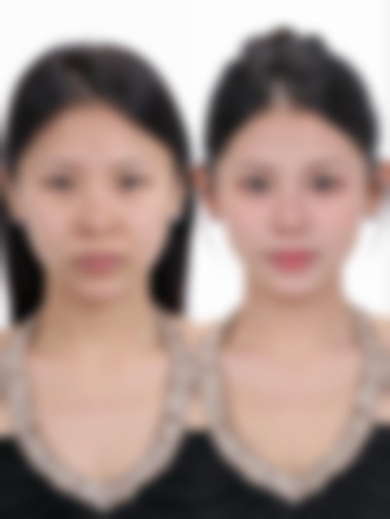 李威扬医生技术与实力