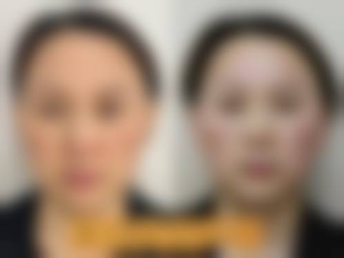 杭州丽星整形医院医生团队经验稳定。
