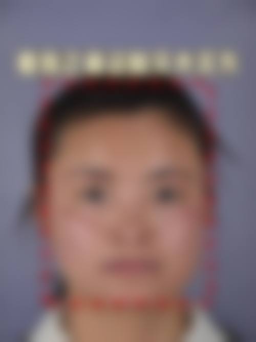刘敏先医生擅长项目