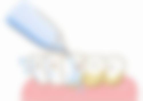 四、张店益美口腔特色项目
