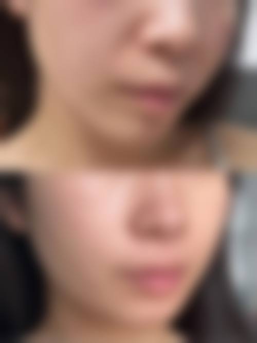 天长美人质造科妍整形医院医生团队经验稳定。