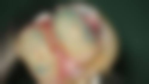 广州南沙诚飞口腔门诊部治疗反馈与口碑评价。
