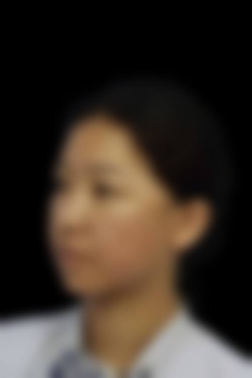 德州友谊医疗整形治疗反馈与口碑评价。