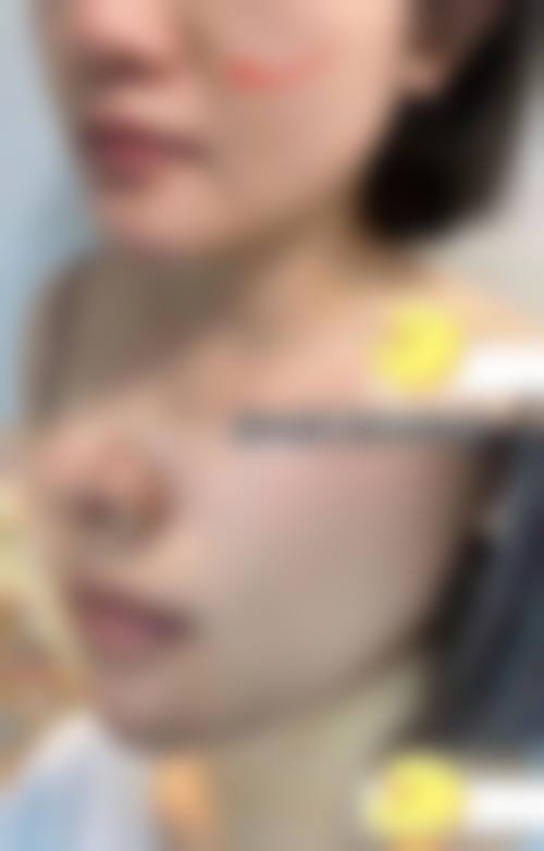 德州友谊医疗整形擅长项目。