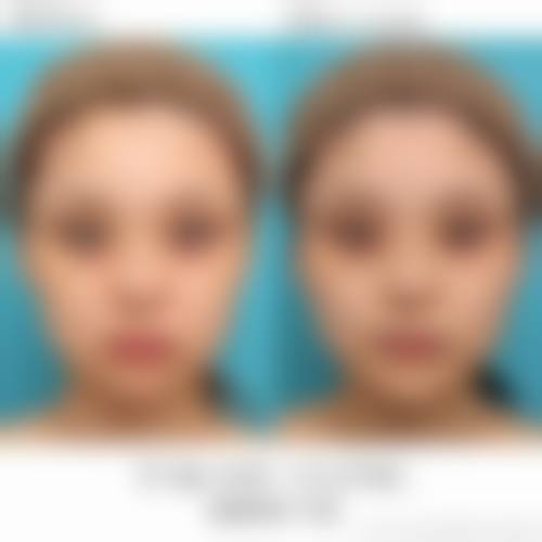 广州臻浠美整形医院2026年价格收费表：