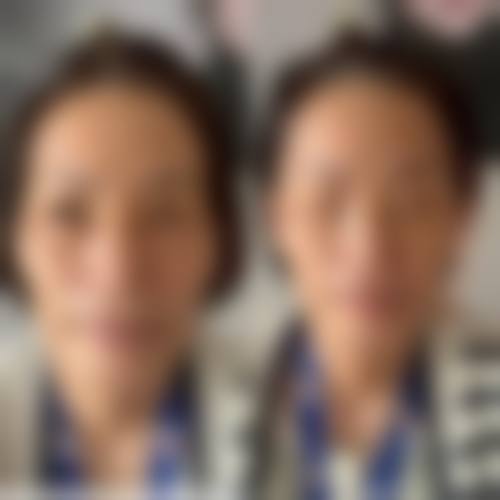 天长美人质造科妍整形医院擅长项目。