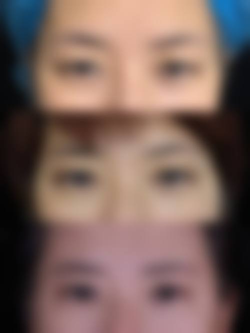 广州臻浠美整形医院项目优势显著。