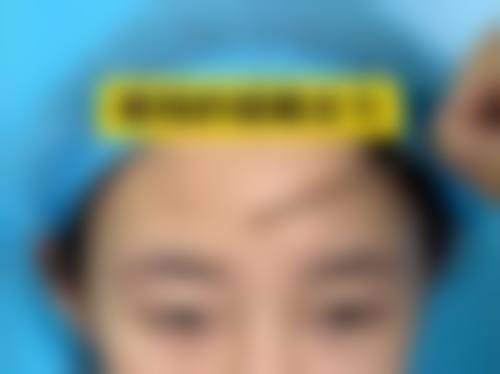 莱州市中医医院眼科治疗反馈与口碑评价。
