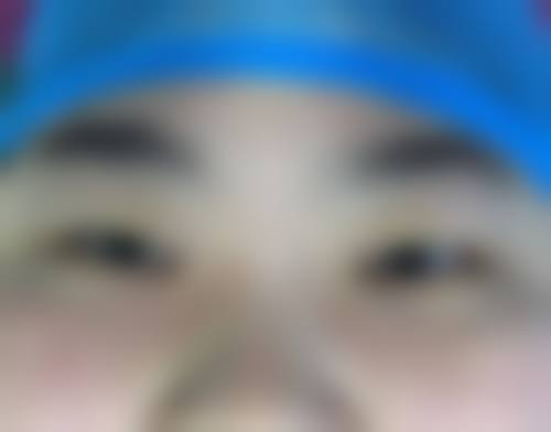 仁寿爱尔（爱瑞）眼科医院擅长项目。