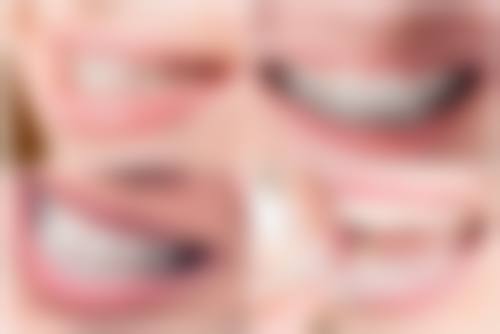 三、科学的补牙流程