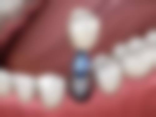 六、天津舒裕口腔(北辰店)口碑如何？