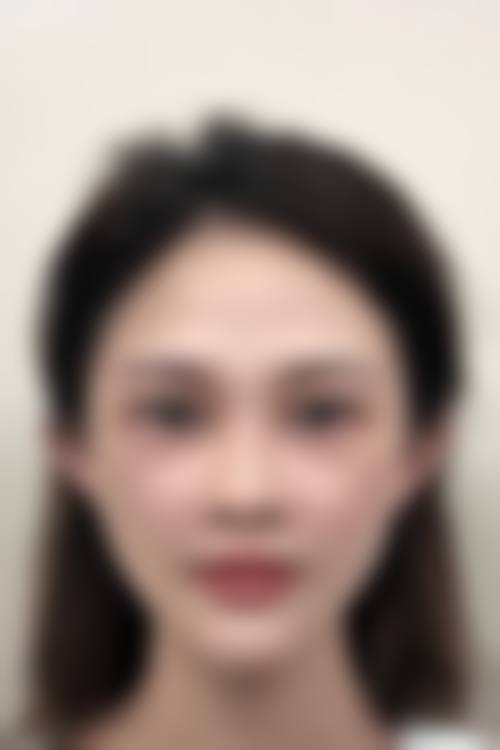 乌鲁木齐奥兰沁整形医院治疗反馈与口碑评价。