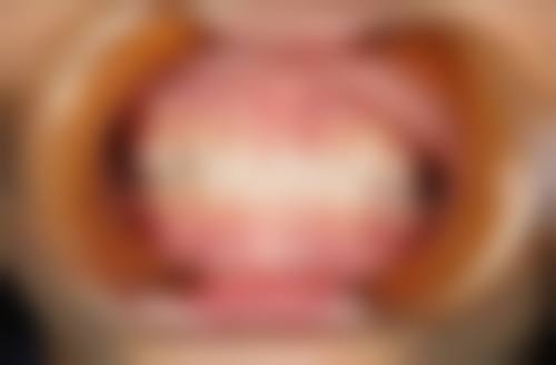 优伢仕口腔医院治疗反馈与口碑评价。