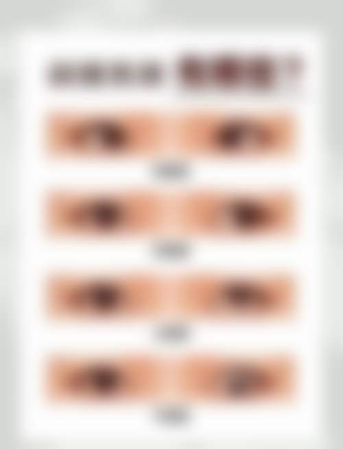 湘西爱尔眼科医院擅长项目。