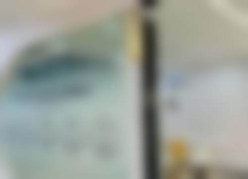 隐形矫正实例展示
