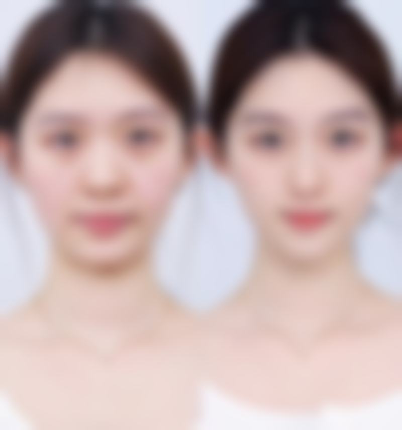 南昌亚太医疗美容治疗反馈与口碑评价。