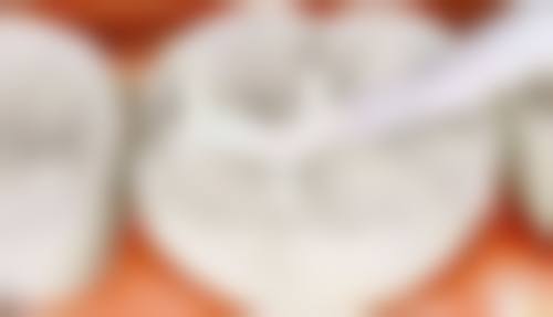 五、番禺林克口腔门诊部收费价格表
