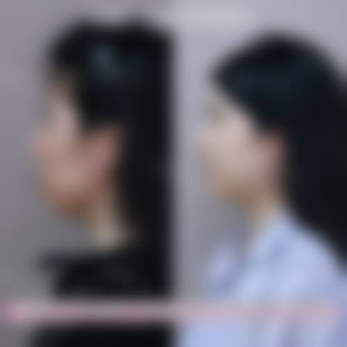 东莞韩亚口腔擅长项目。