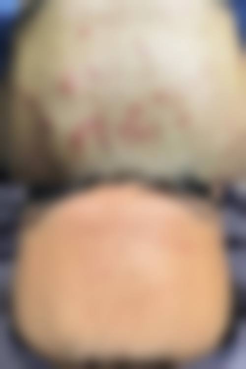 南昌针美荟整形医院预约挂号方式。