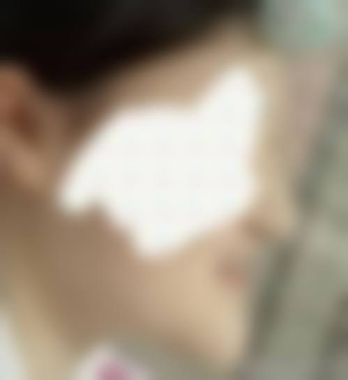 荆州沙市伊莱美医疗美容门诊部治疗反馈与口碑评价。