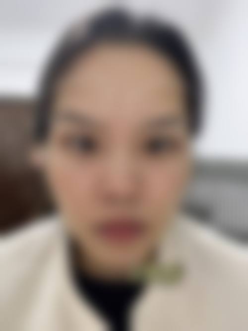 成都高新伊瑞斯医疗美容门诊部擅长项目。