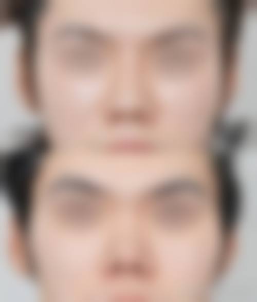 太仓仁慈整形美容医院擅长项目。