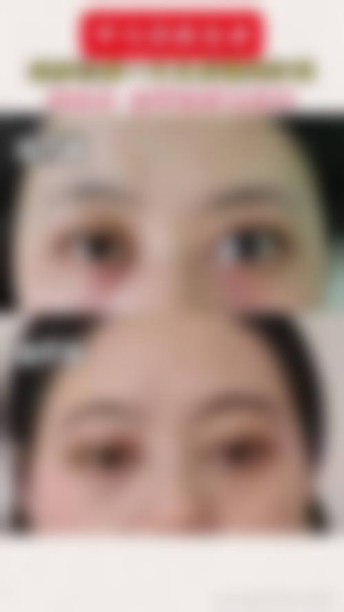 内蒙古自治区中医医院眼科门诊营业时间。