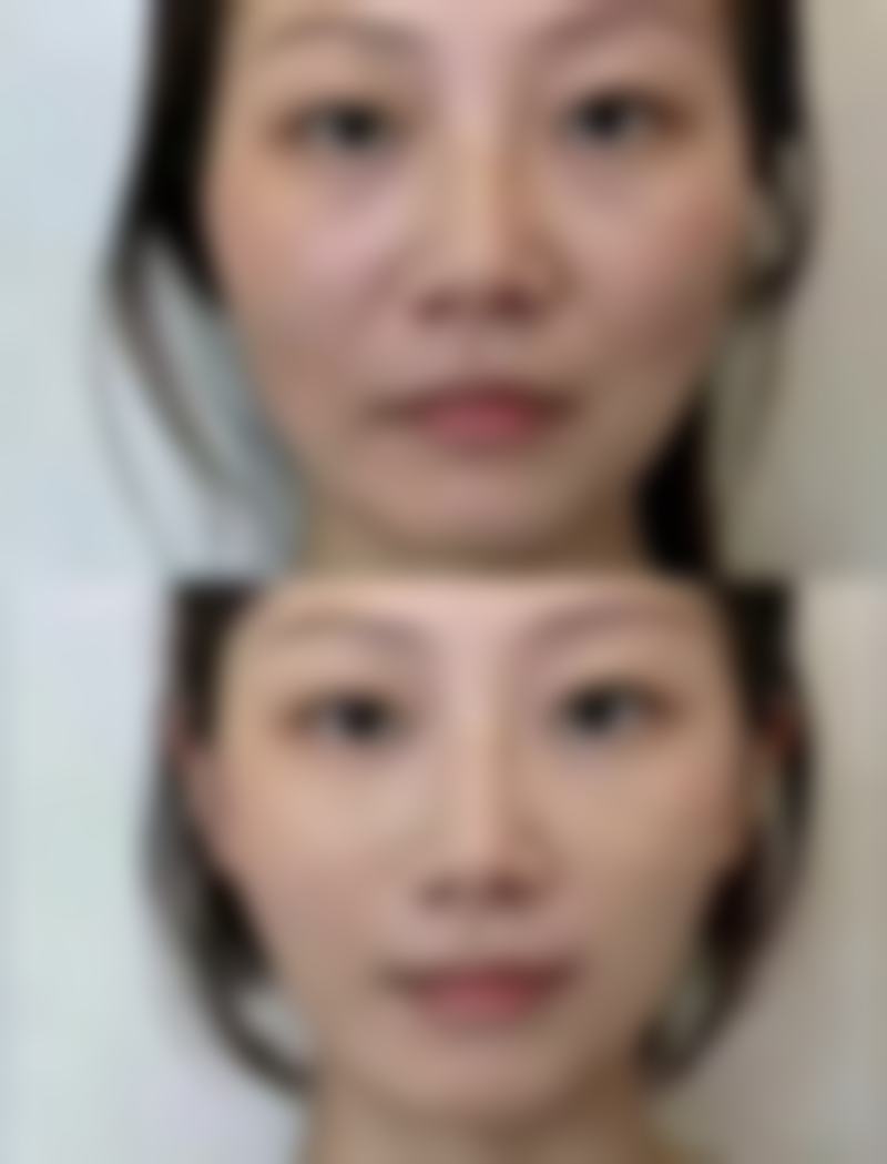 河南大学附属南石医院烧伤整形美容中 心口碑评价
