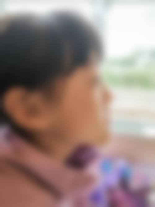 张曦鸿医生的技术实力