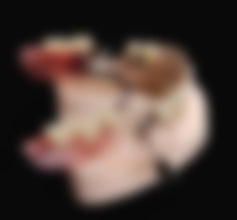湘潭美湘口腔治疗反馈与口碑评价。