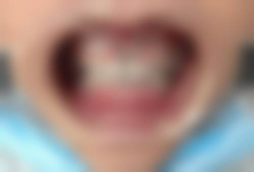 长沙优伢仕口腔(总院)治疗反馈与口碑评价。
