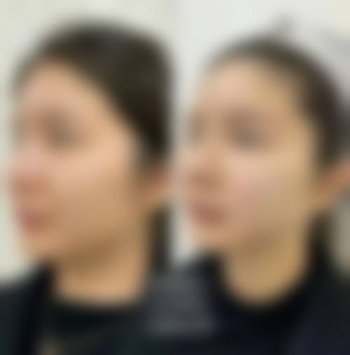 韦清洁医生擅长项目
