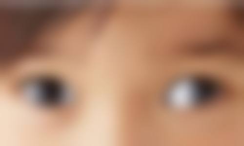 河南商丘尖峰眼科医院2026年价格收费表: