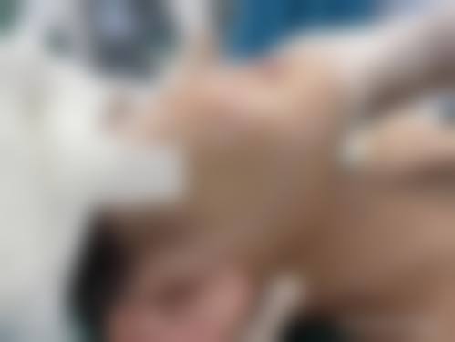 韦清洁医生技术实力展示