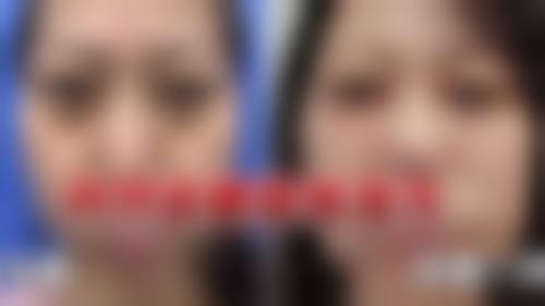 沈阳汇美人医疗美容诊所2026年价格收费表：