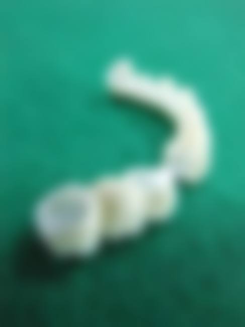 长沙优伢仕口腔(总院)擅长项目。