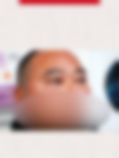 贵州毕节威宁视康眼科医院治疗反馈与口碑评价。