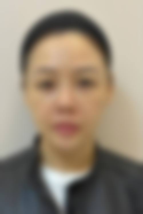 朔州华美张鹏整形医院预约挂号方式。