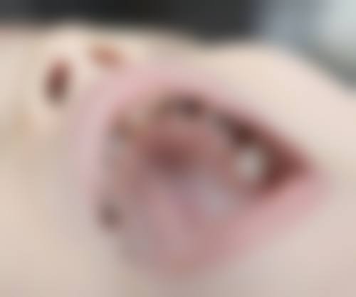 保山吴宝来口腔诊所医生团队经验稳定。