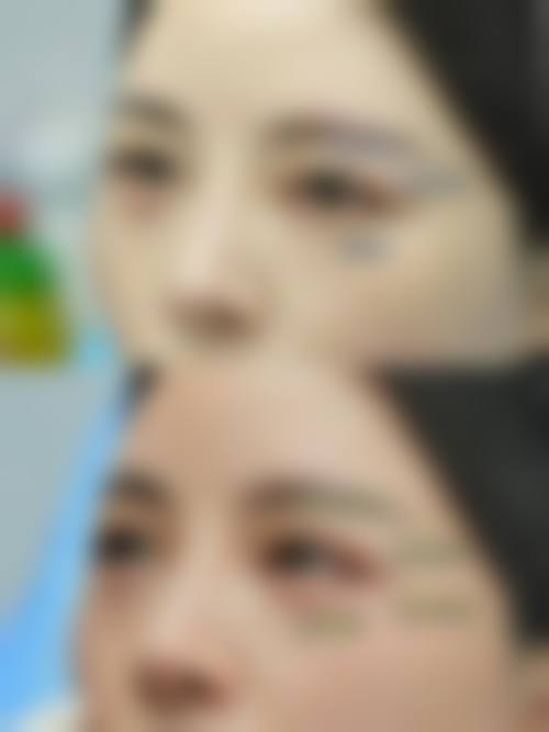 朔州华美张鹏整形医院擅长项目。