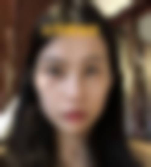 朔州华美张鹏整形医院医生团队经验稳定。