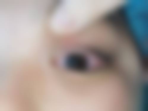 汕头博德眼科医院治疗反馈与口碑评价。
