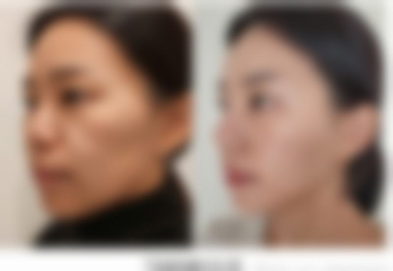 海口美兰添美整形外科诊所预约方式