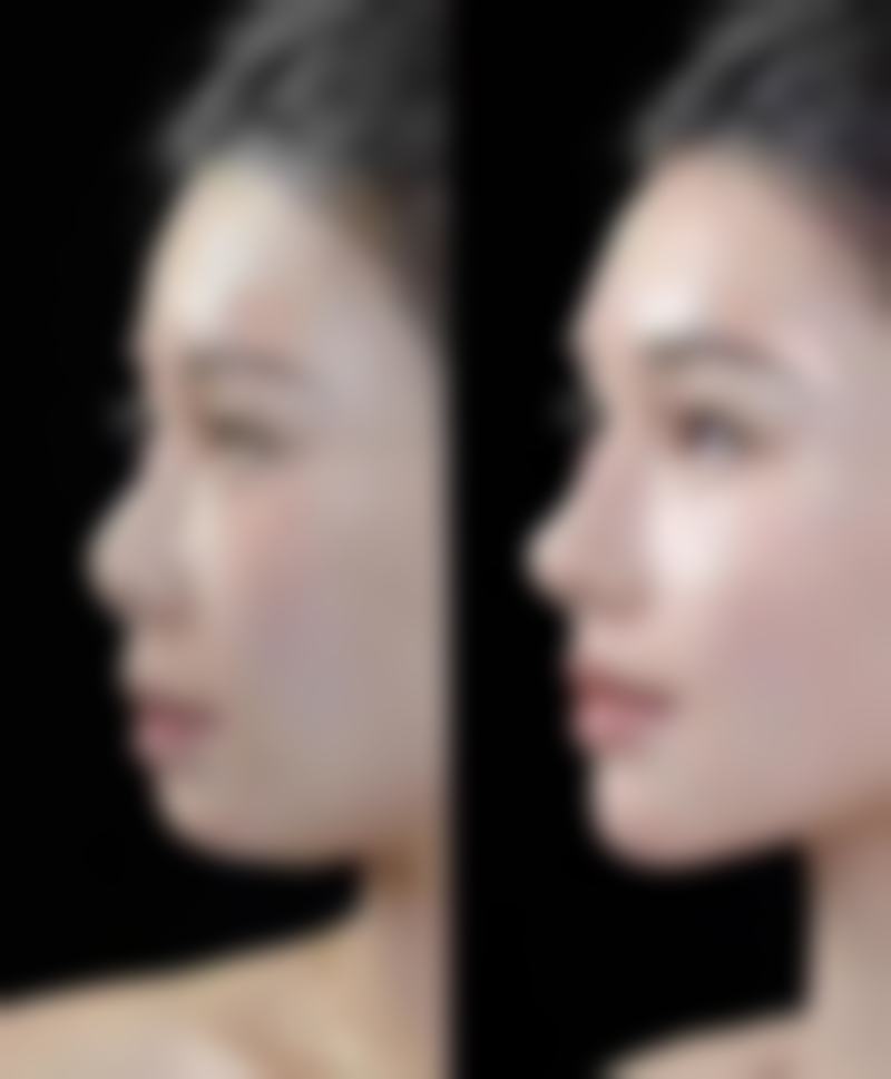 海口美兰添美整形外科诊所项目价格
